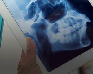 TMJ or Jaw Injuries