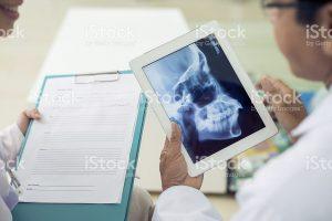 jawinjuries