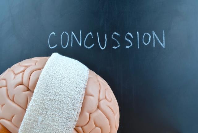 4 myths about minor Traumatic Brain Injuries